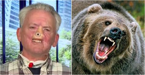 Man survives bear attack but loses face - North Carolina man survives surprise bear attack An elderly man fights off a mother bear and her two cubs in his driveway. November 9, 2018